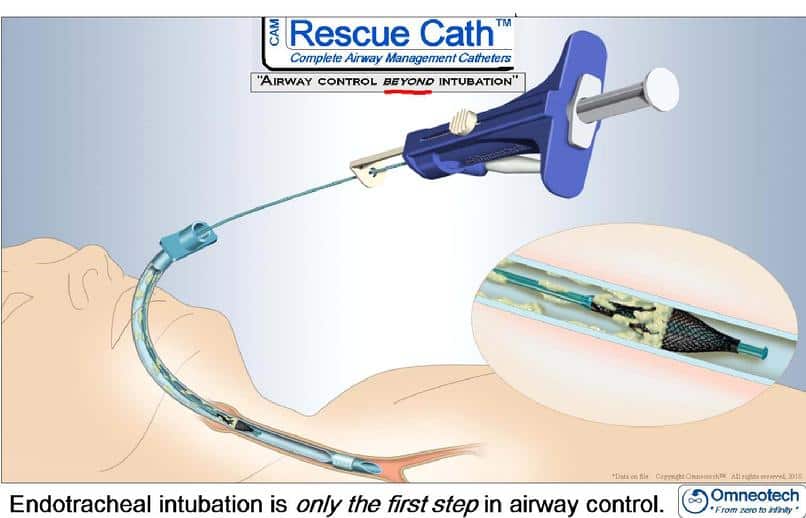 Omneotech Cam Rescue Cath